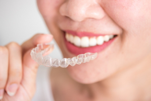 Ortodonzia invisibile: il cambio di paradigma verso un sorriso migliore